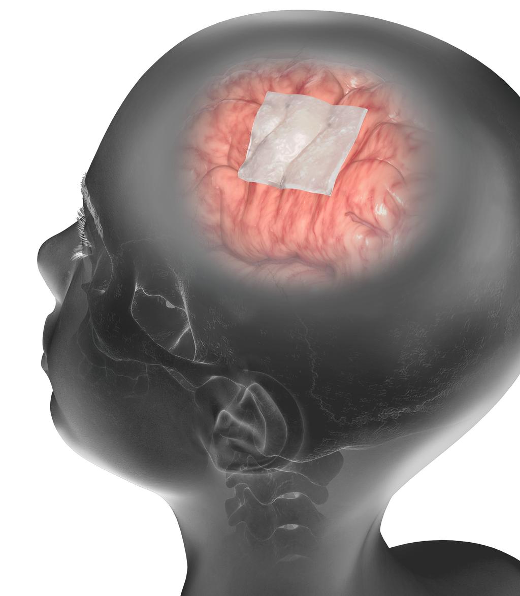 Cargar imagen en el visor de la galería, DuraMatrix